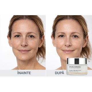 crema regeneranta fata peptide microbiom anaconda professional 50ml